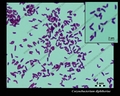 corynebacterium diphtheriae